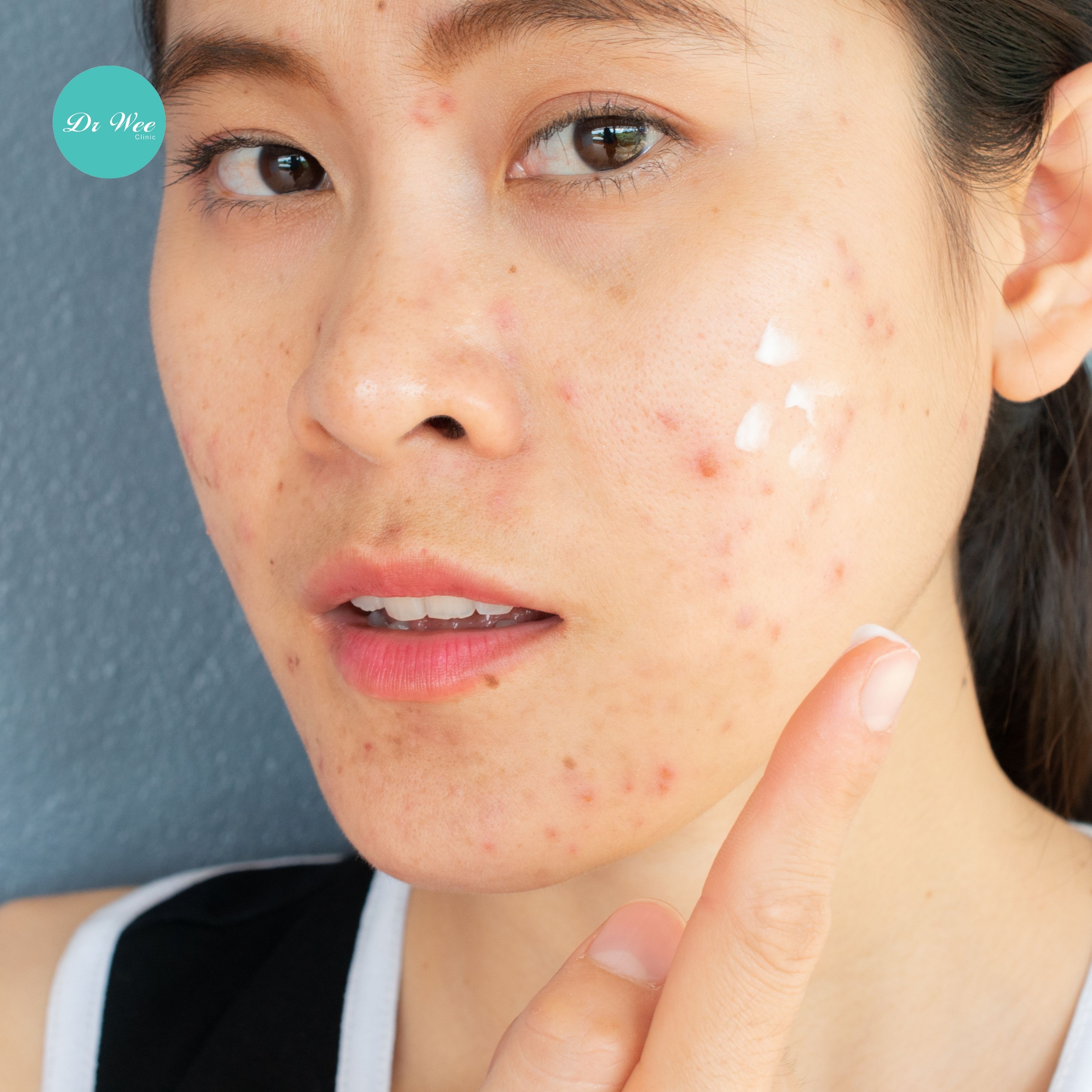 Dr Wee Clinic 皮肤病门诊、敏感肌及湿疹临床诊断与治疗