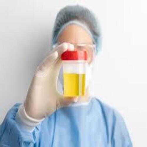 Urine Test