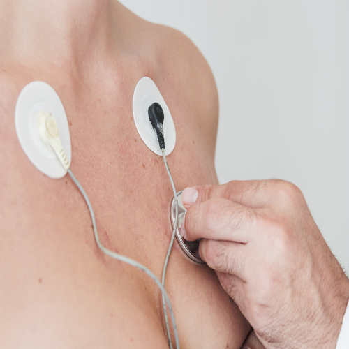 ECG (Electrocardiogram)