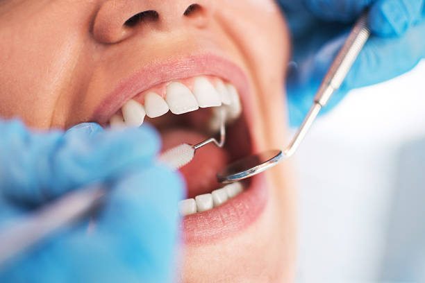 Smile Design
