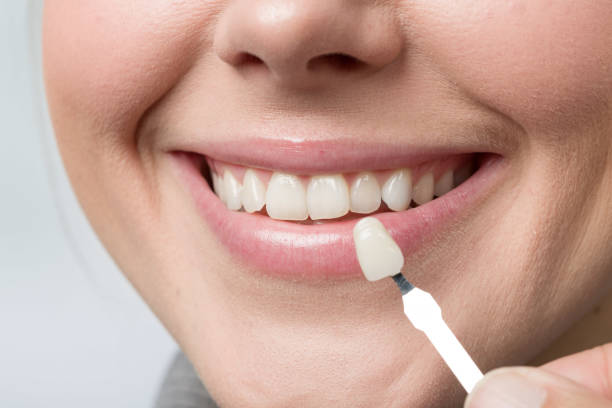 Invisalign