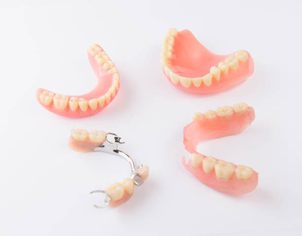 Partial Dentures