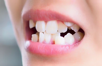 Minimally Invasive