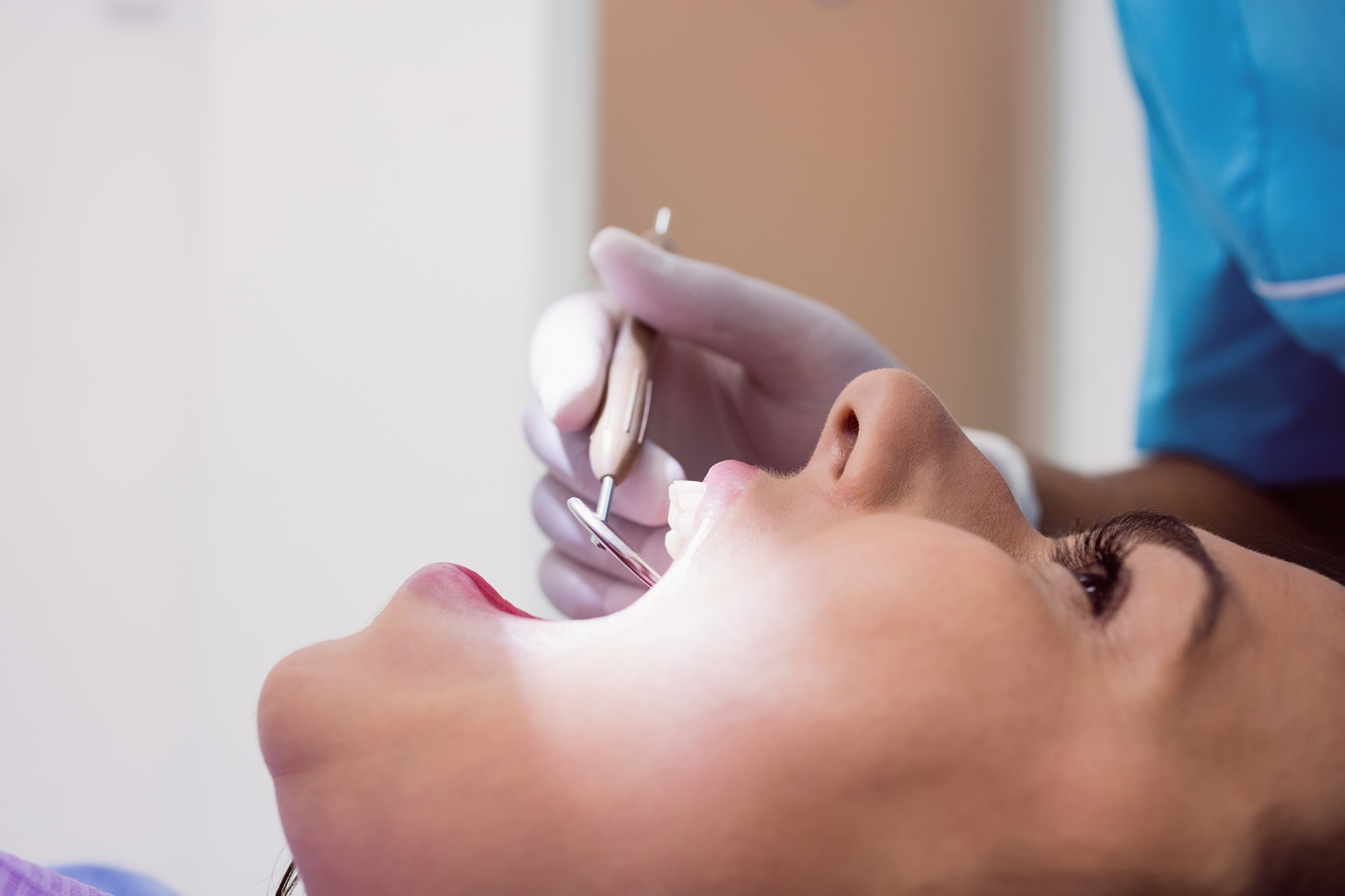 Wisdom Tooth Removal
