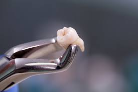 Simple Extraction