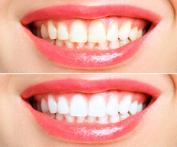 Fast & Long-Lasting Results