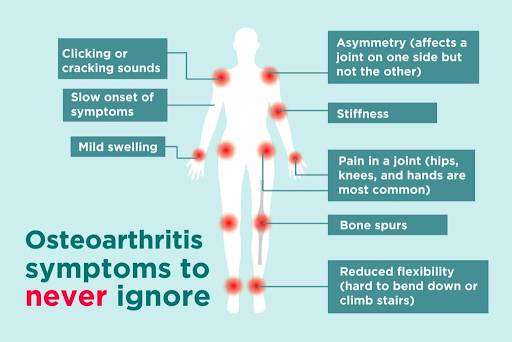 Knee Osteoarthritis