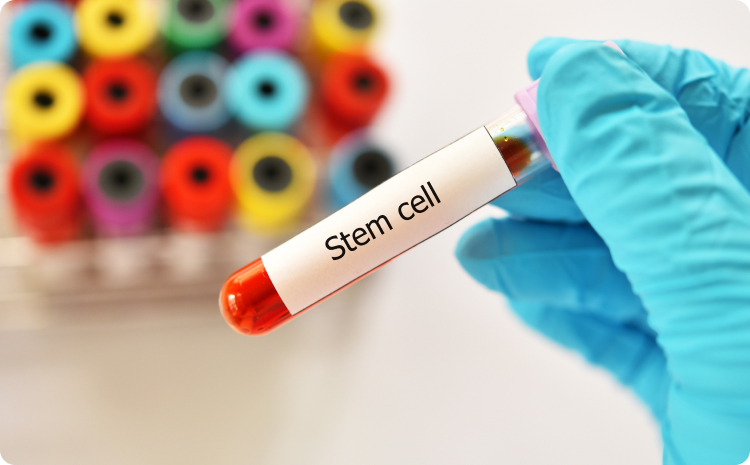 Mesenchymal Stem Cells Pixel Clinic Mesenchymal Stem Cells Pixel Clinic
