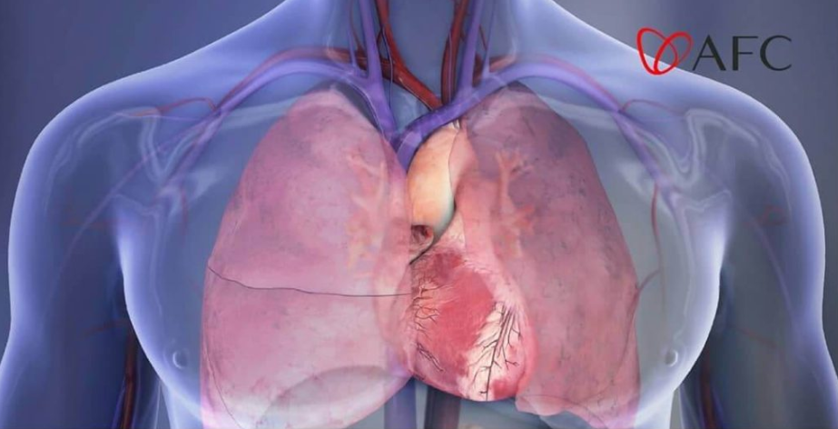 21,700+ Deep Vein Thrombosis Stock Photos, Pictures & Royalty-Free Images