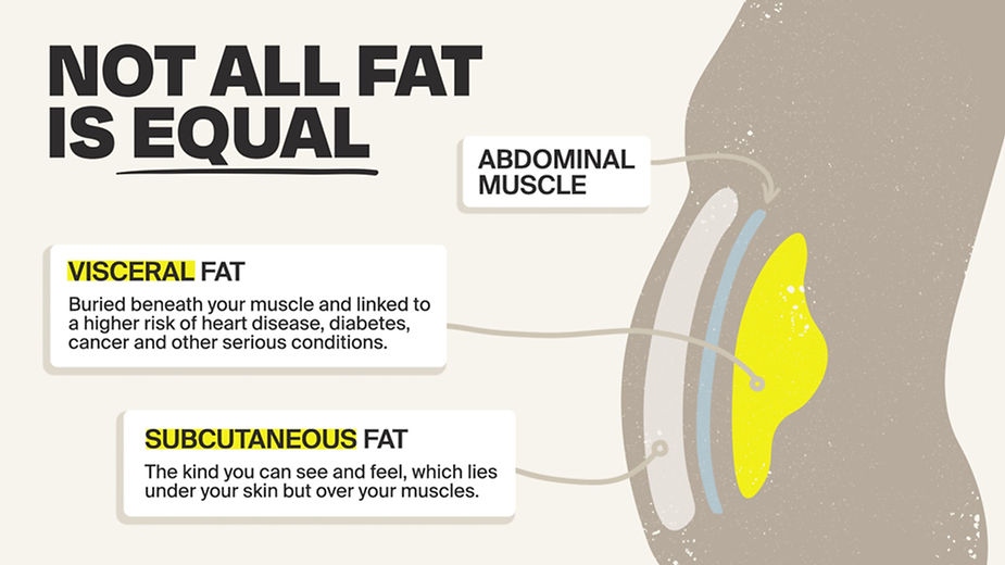 Visceral Fat