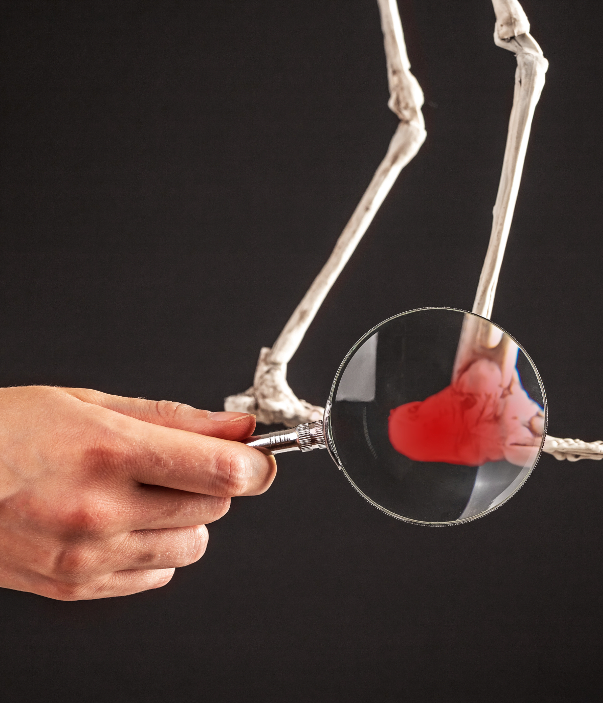 Plantar Fasciitis Illustration 1