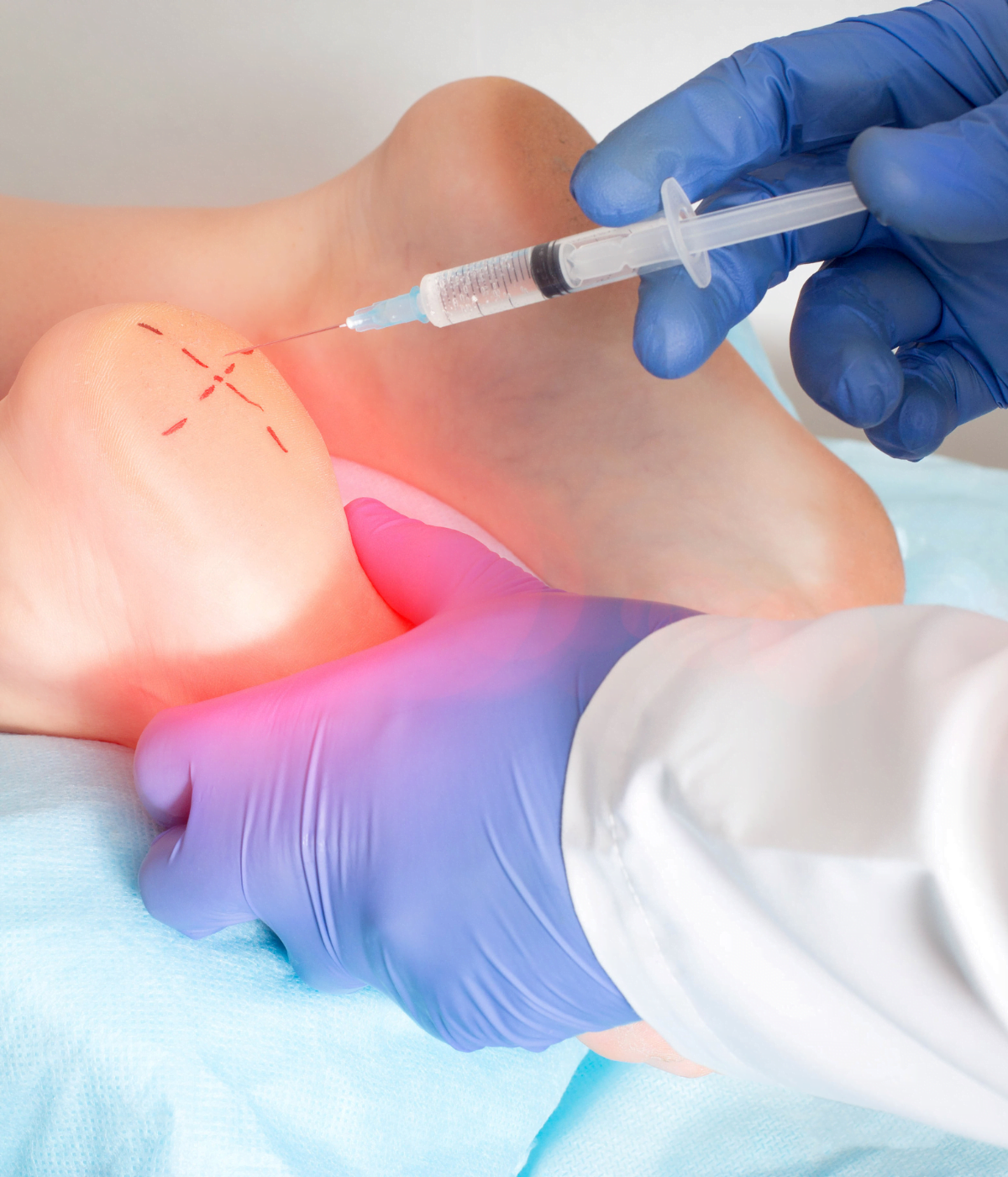 Foot Support Illustration